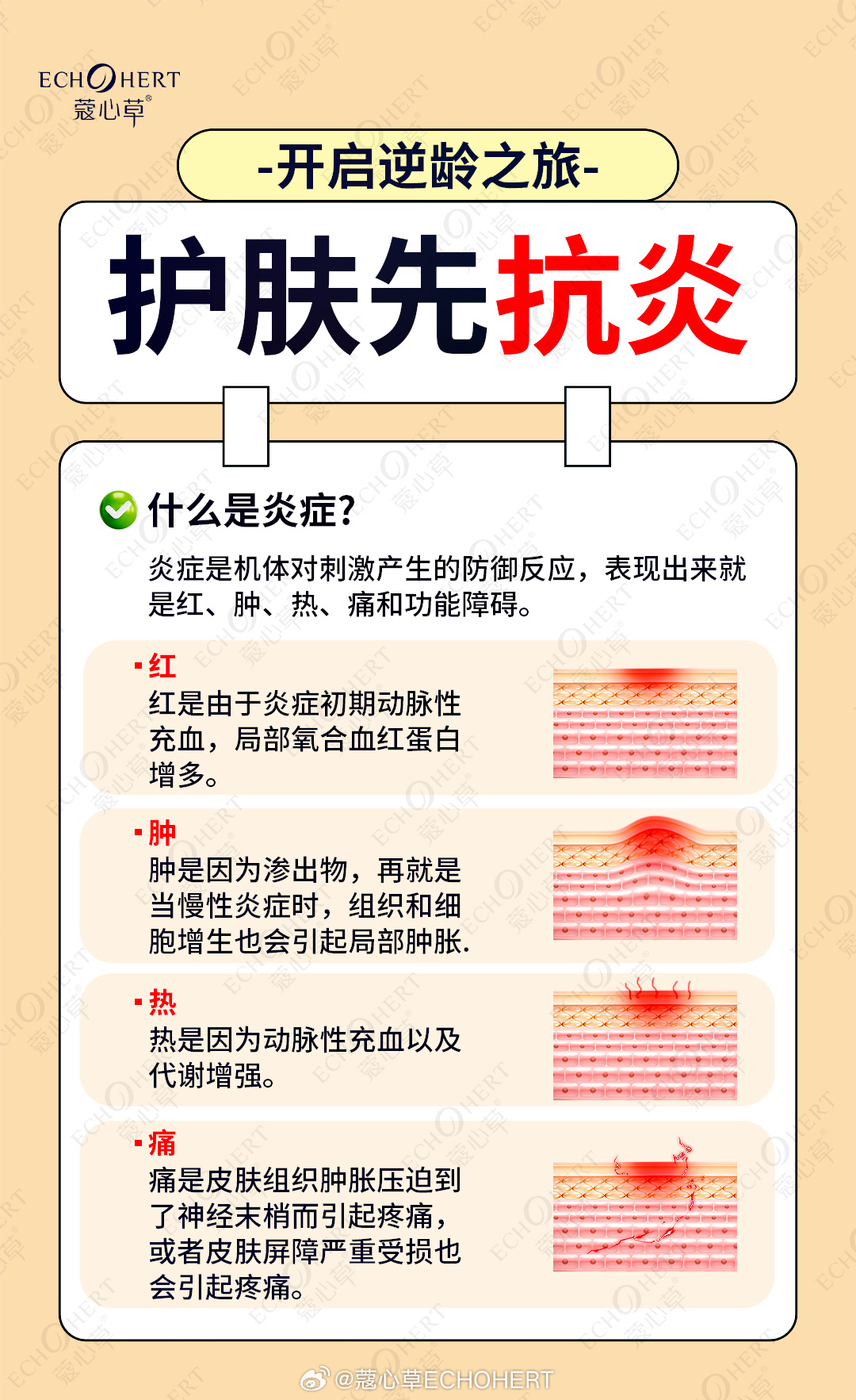 最新抗炎,最新抗炎，全面步驟指南